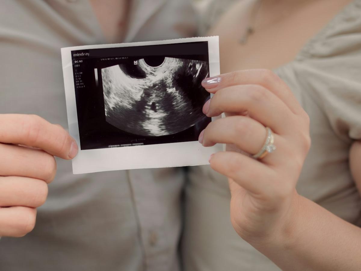Hands holding a printed pregnancy ultrasound image